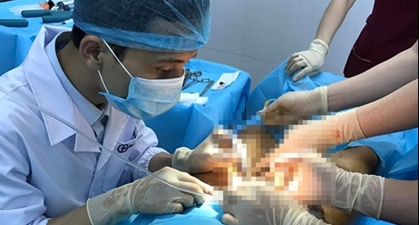 Thiếu cơ sở chăm sóc y tế cho người chuyển giới